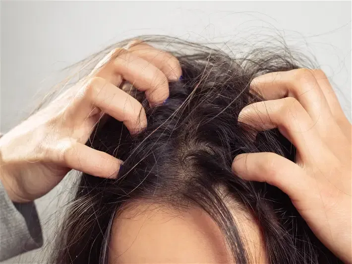 Foto einer Frau, die mit beiden Händen die Kopfhaut kratzt.